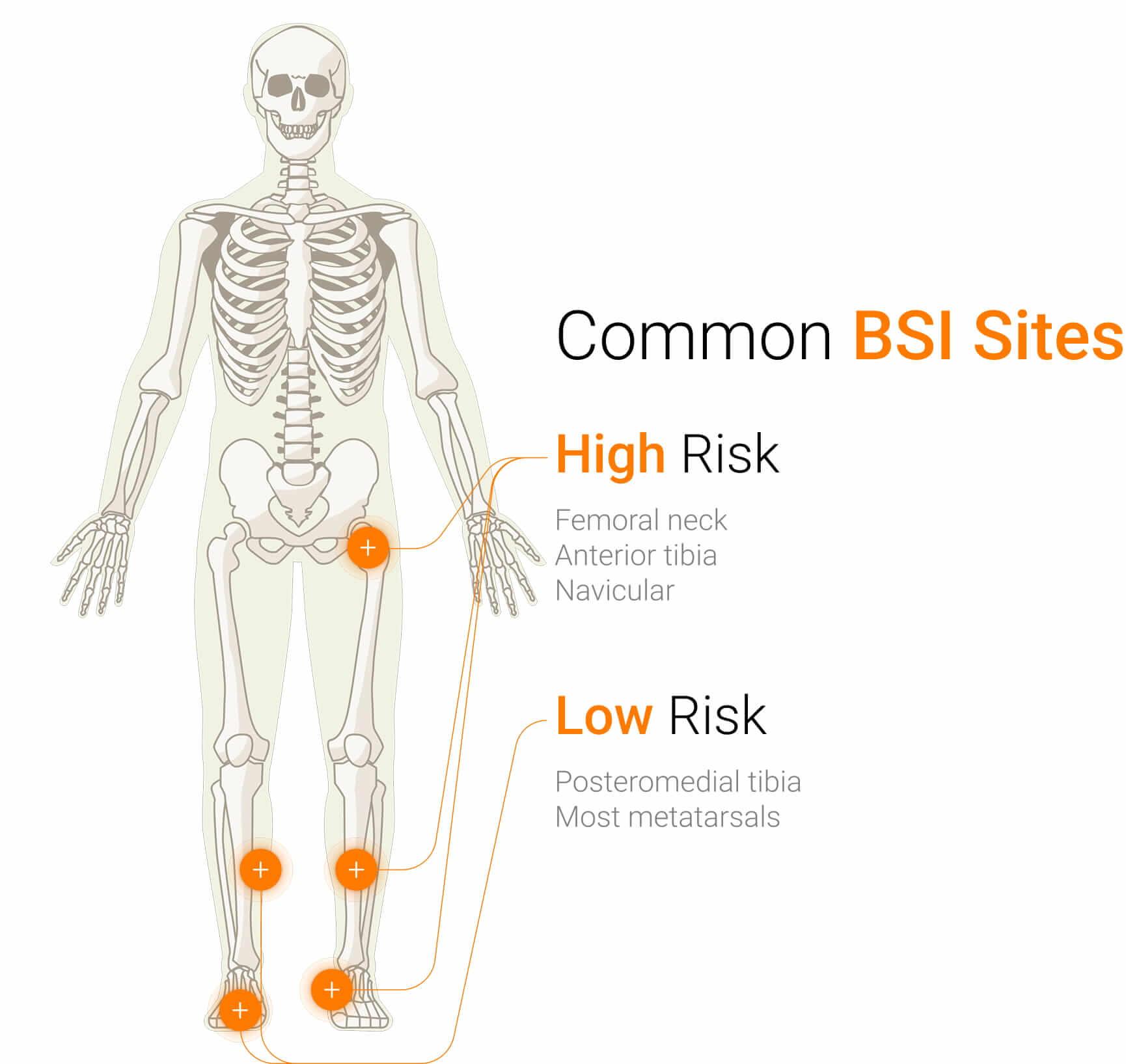 Common BSI Sites