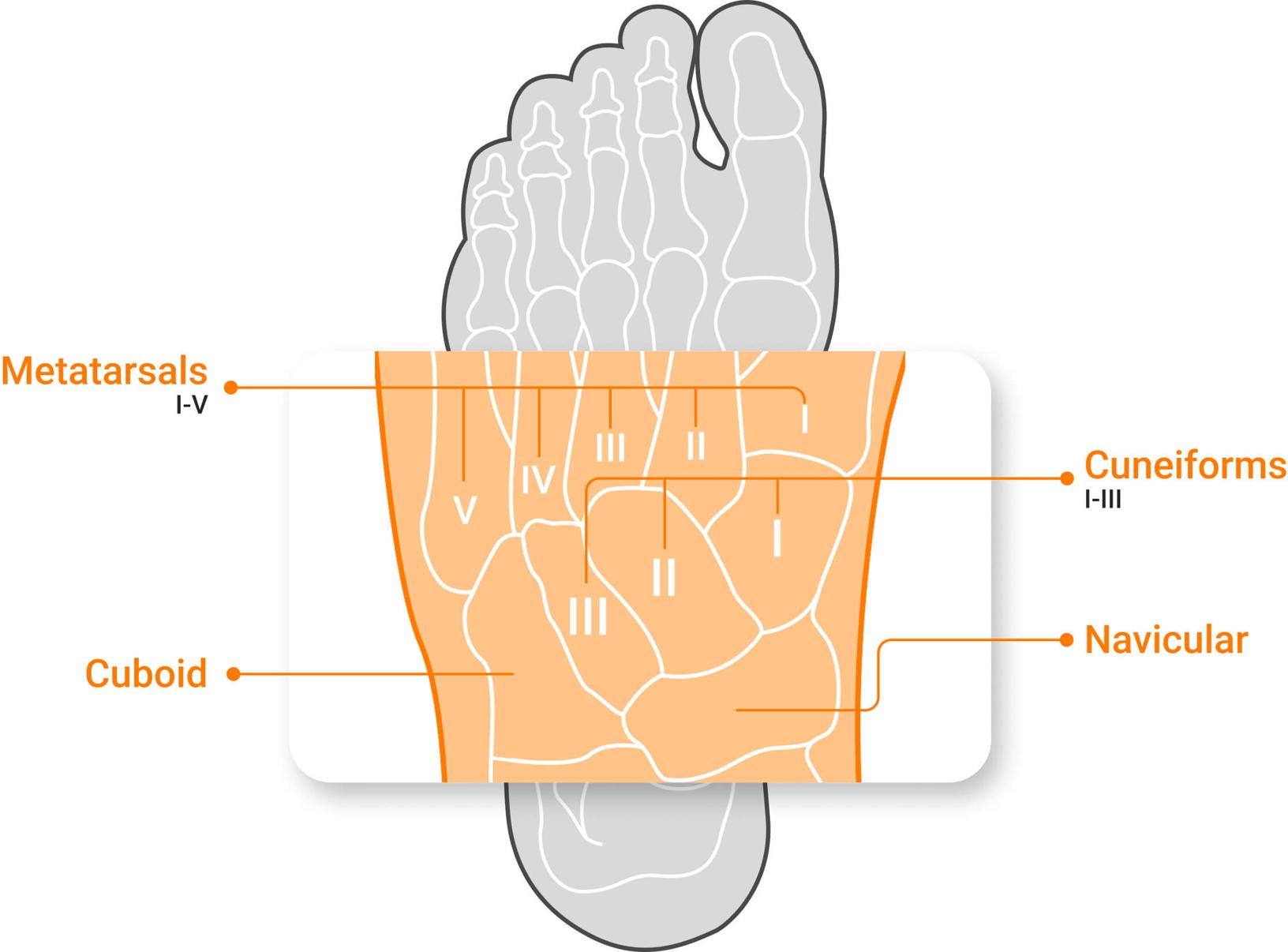 Anatomy of the midfoot bones, with labels indicating the region where the injury occurs