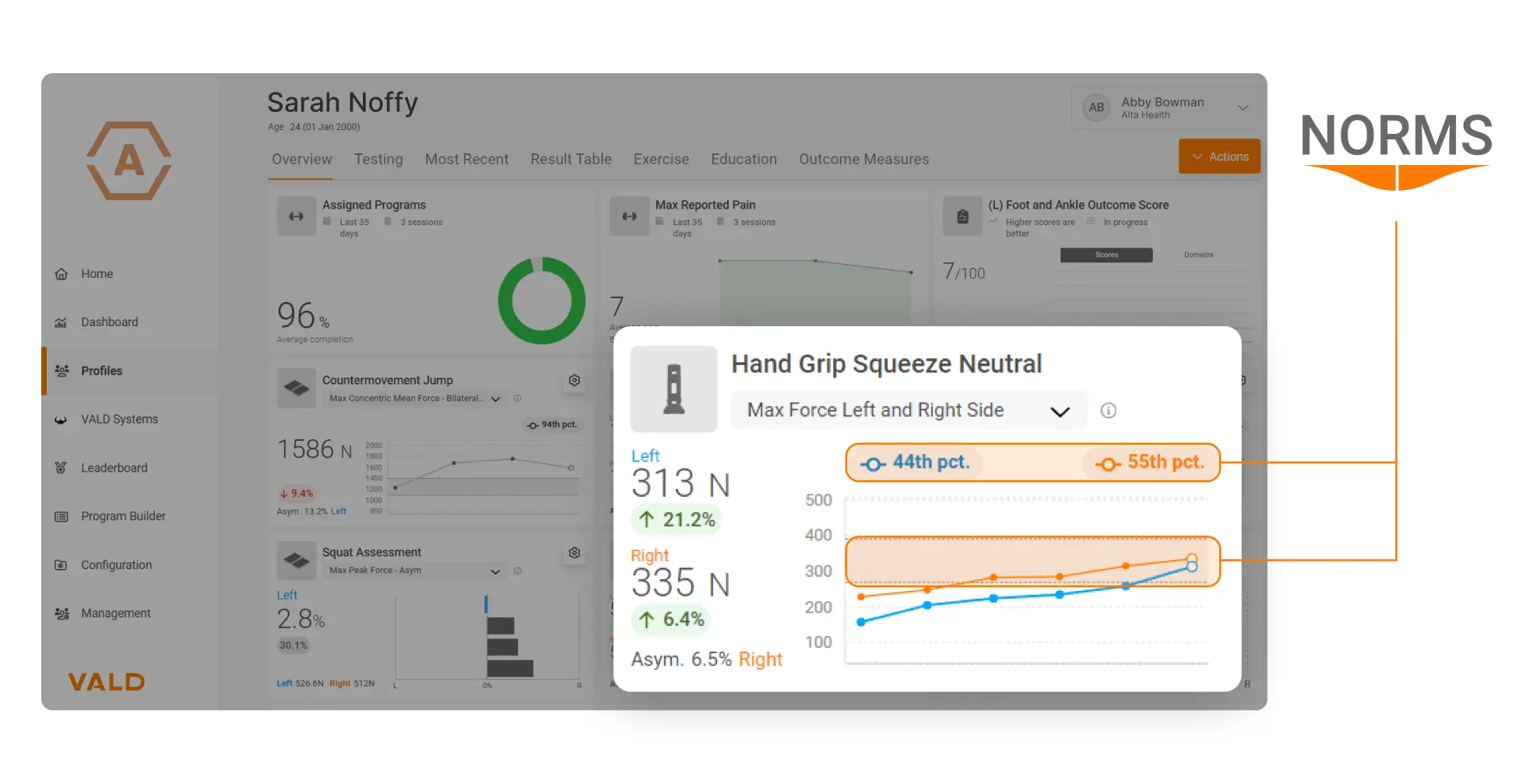 Norms can be used to compare an individual’s results over time and are available for almost all DynaMo strength tests and metrics, including bilateral metrics.