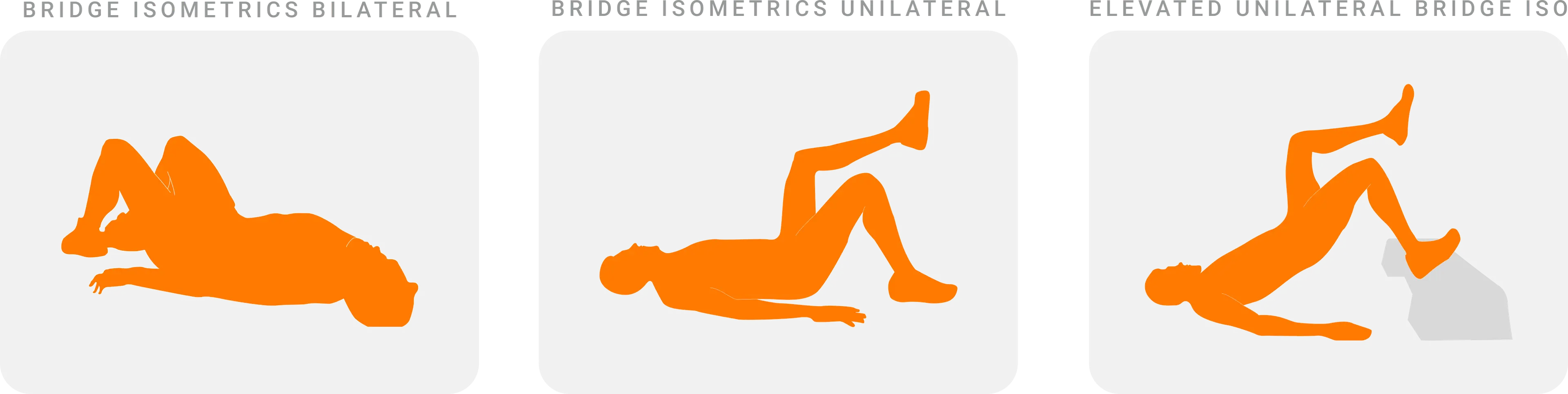 Bridge progressions used in mid-stage hamstring rehabilitation.