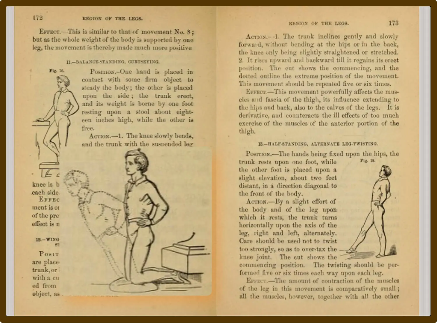 Excerpt from Health by Exercise, an early guide to using targeted movement to address physical weaknesses (Taylor, 1880).