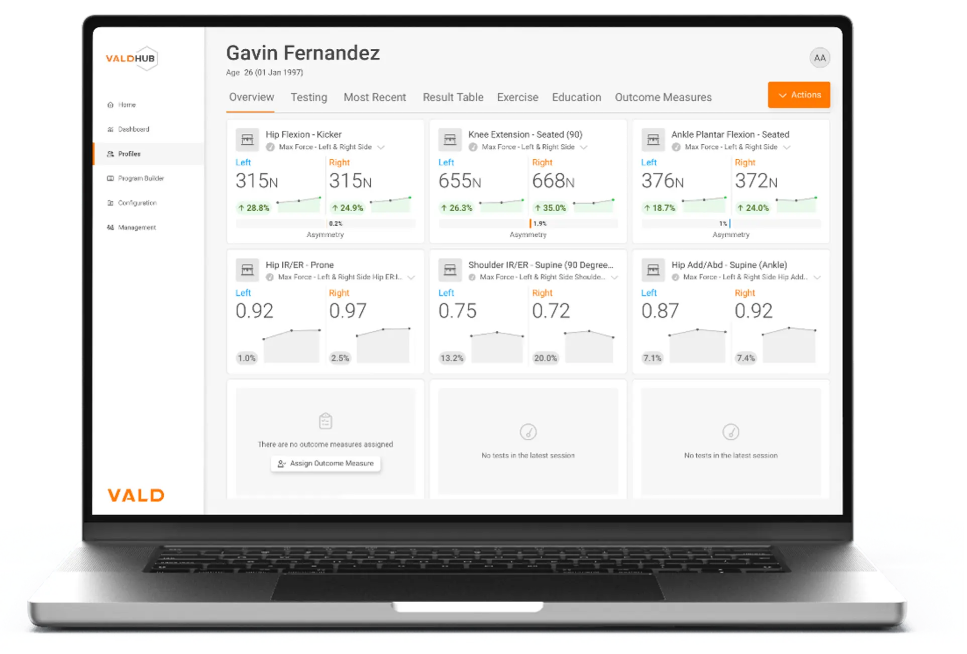 VALD Hub에서 ForceFrame 테스팅 데이터 수집과 시각화 예시