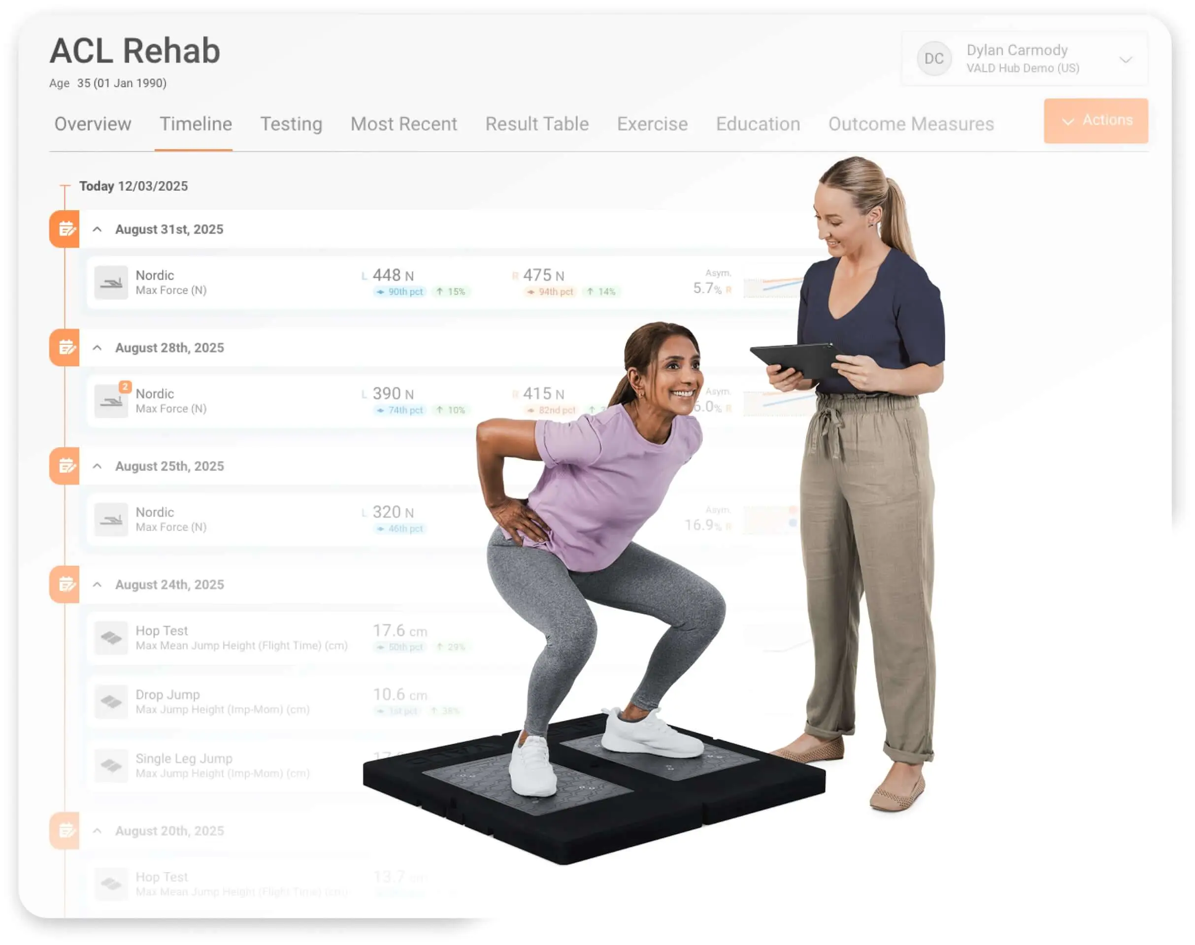 Patient and practitioner testing during rehabilitation with VALD Hub’s Timeline view visualized.