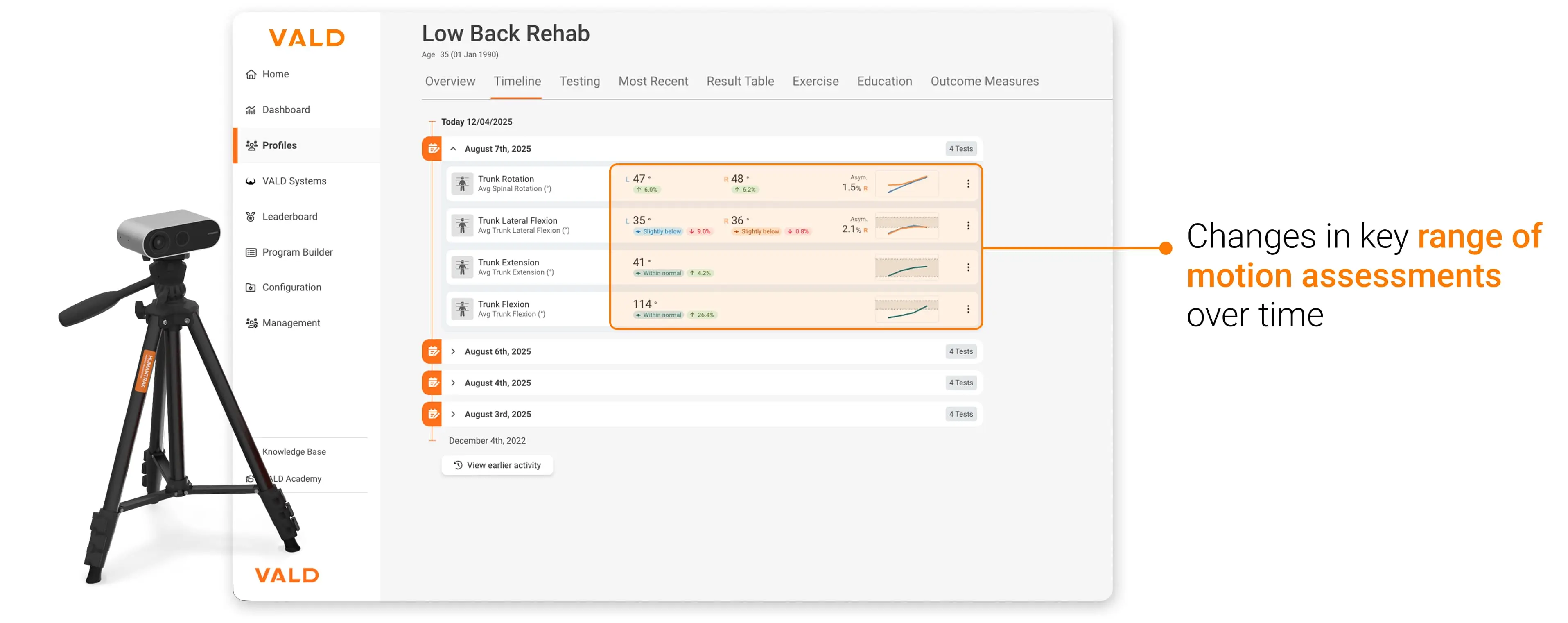 HumanTrak can detect small improvements in motion, as visualized in the timeline view in VALD Hub.